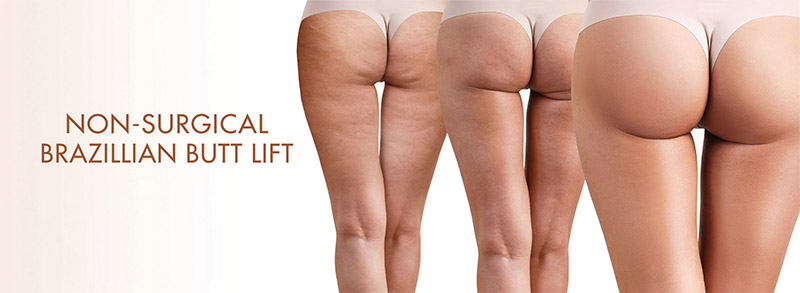 Non-Surgical Brazilian Buttock Lift (BBL) Injections