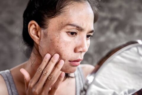 Asian woman inspecting her skin for dark spots and blemishes